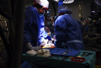 Surgeons operate on Bennett in the procedure on January 7
UNIVERSITY OF MARYLAND