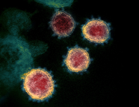 Novel Coronavirus SARS CoV 2 Coronavirus disease 2019 Wikipedia